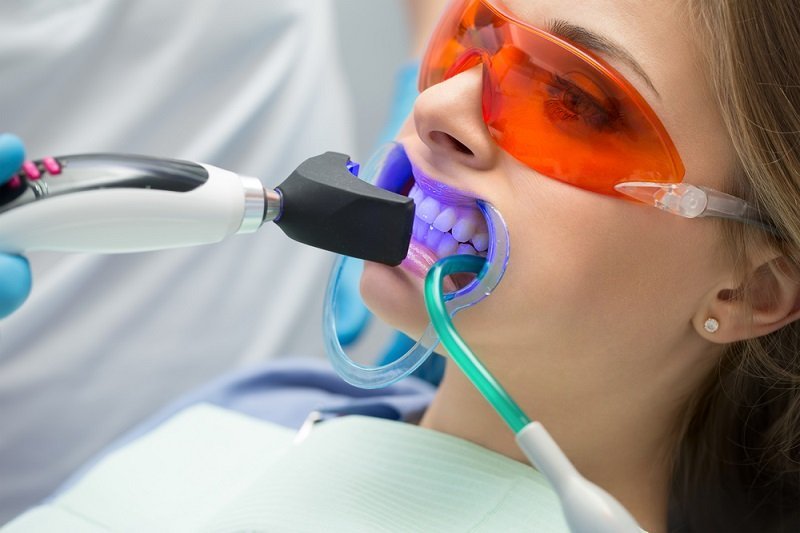clareamento dental