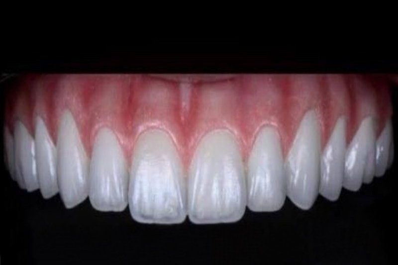 protocolo dentario no centro de odontologia integrada ana rosa com Dr. Renato Pereira (1) (1)